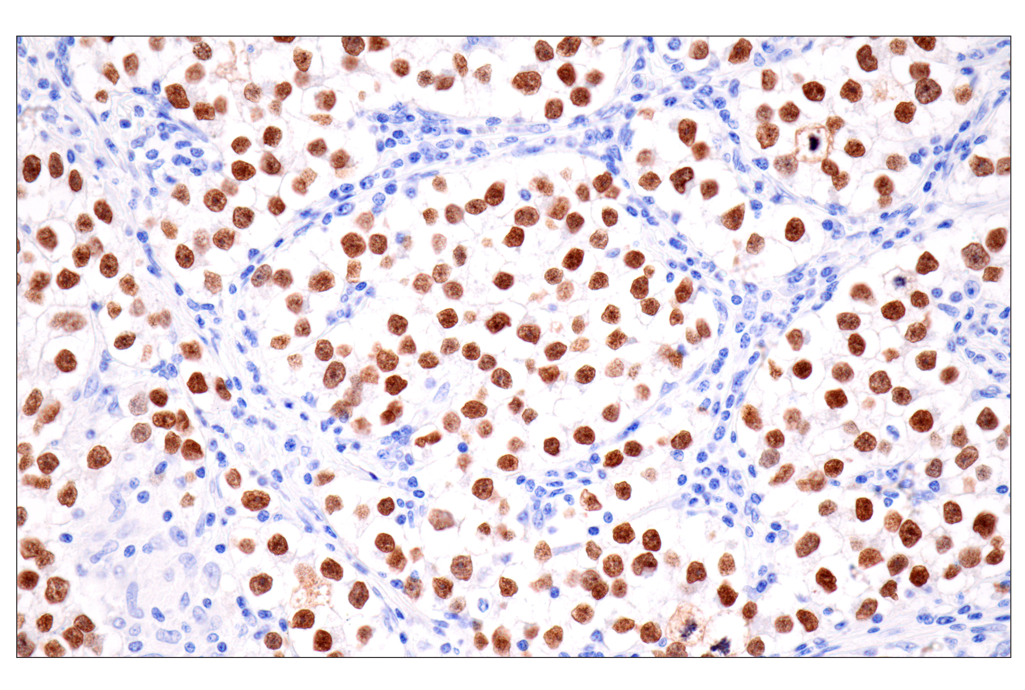 Immunohistochemistry Image 1: Sall4 (6E3) Mouse mAb
