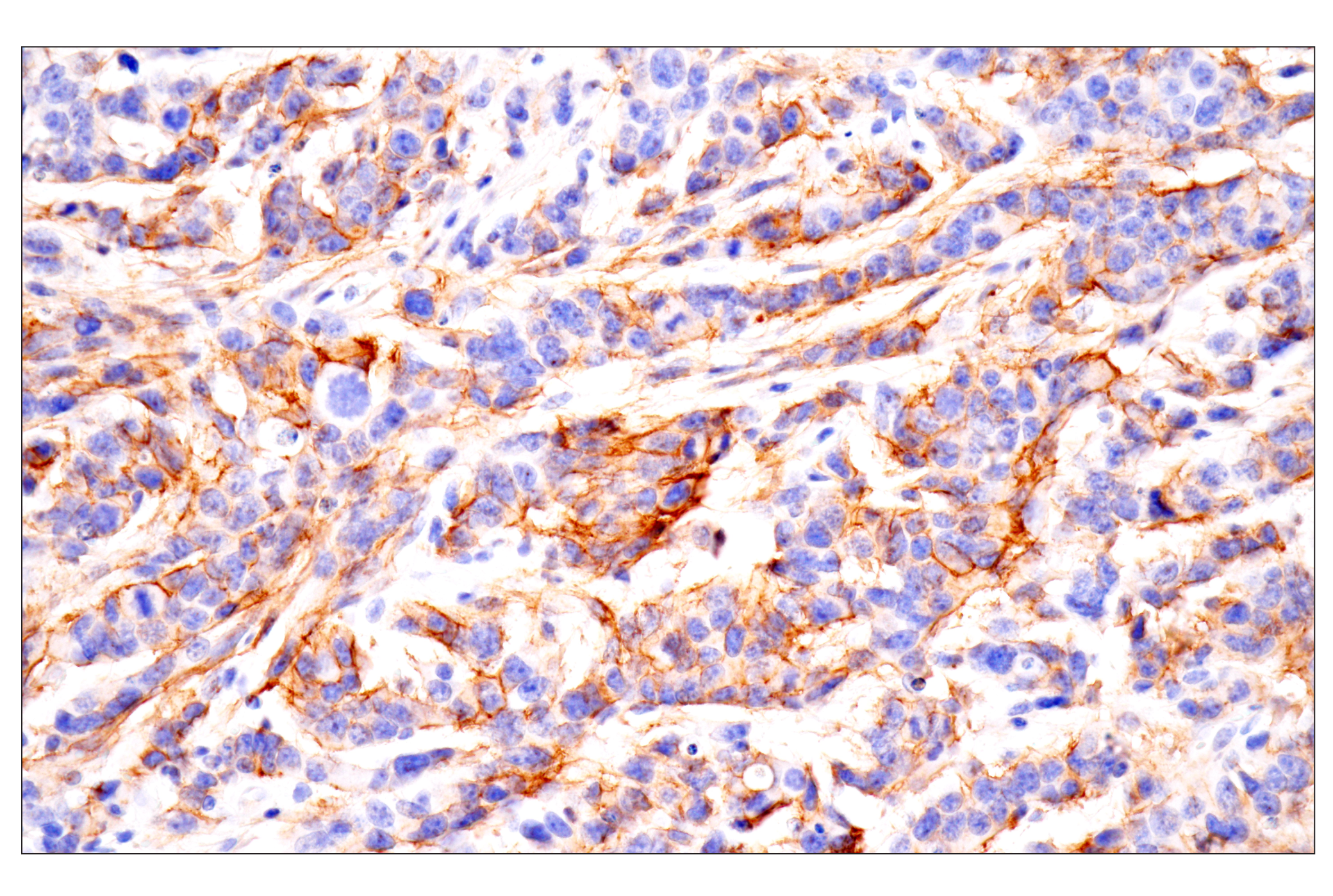 Immunohistochemistry Image 9: PTPRZ1 (E7C8Z) Rabbit mAb (BSA and Azide Free)