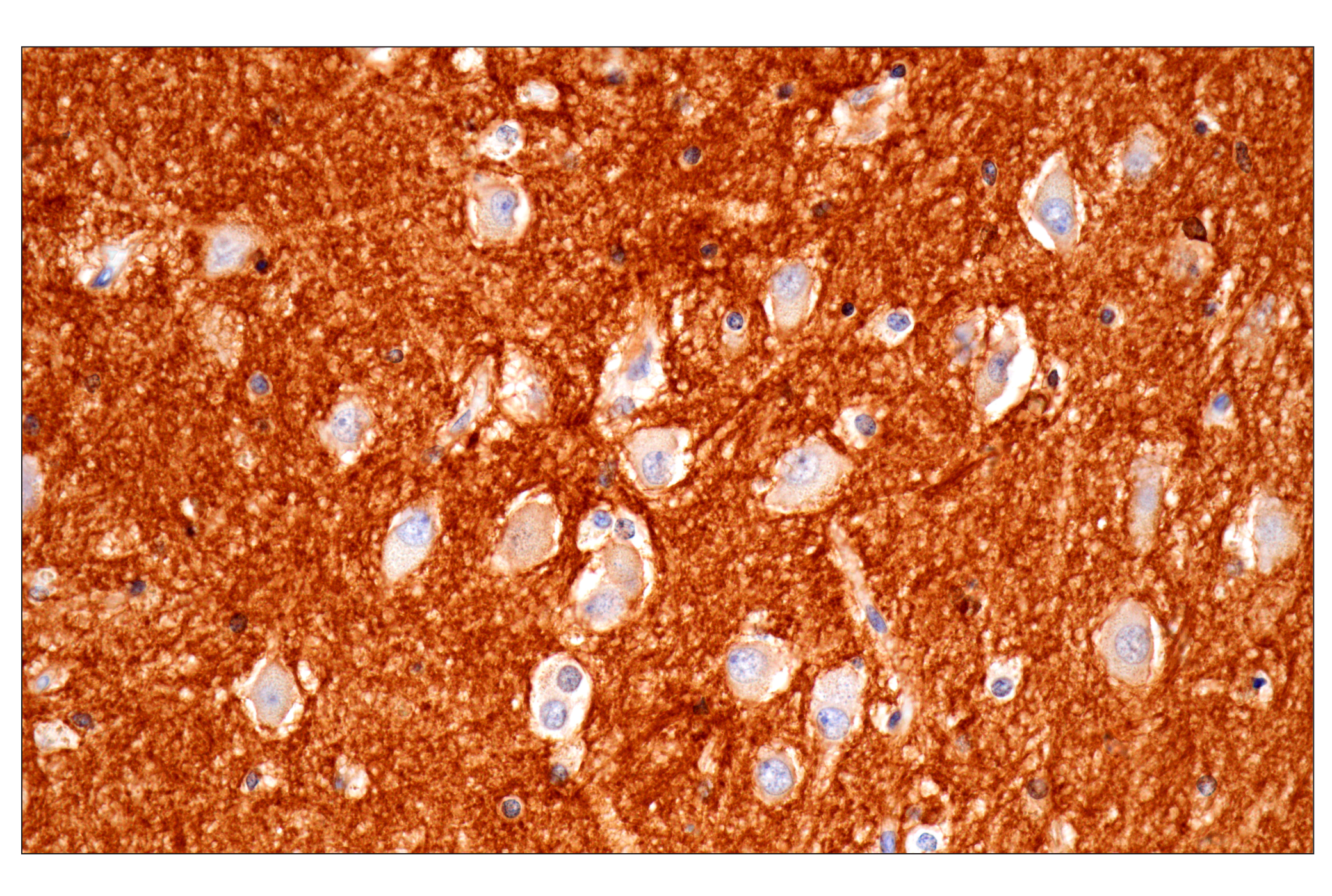 Immunohistochemistry Image 3: PTPRZ1 (E7C8Z) Rabbit mAb (BSA and Azide Free)