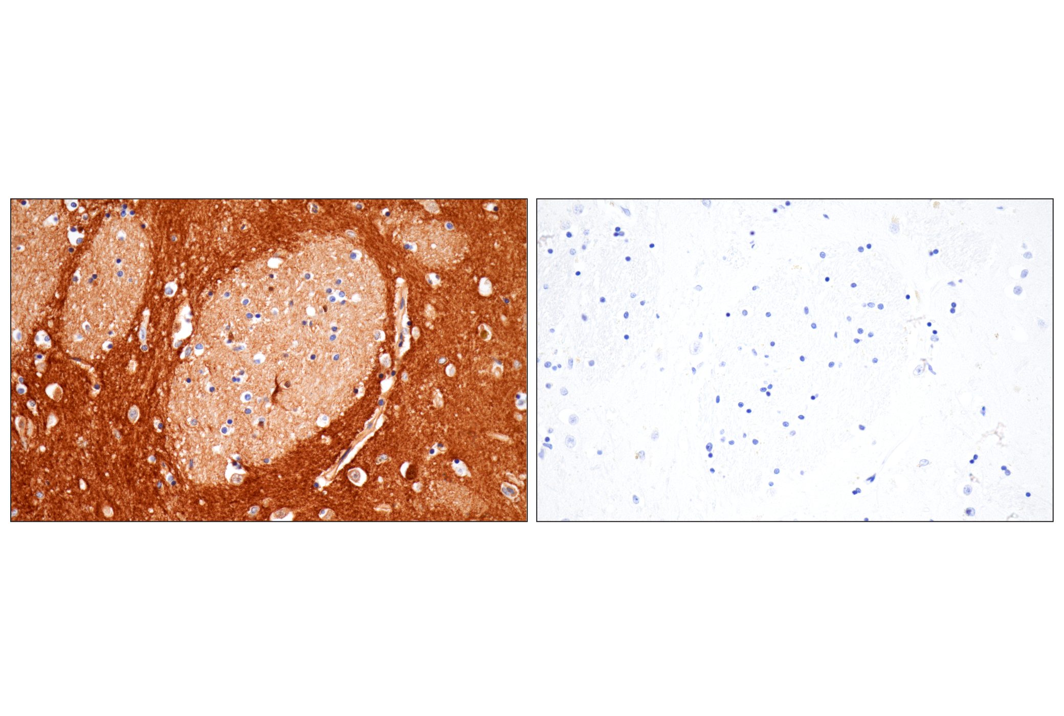 Immunohistochemistry Image 10: PTPRZ1 (E7C8Z) Rabbit mAb (BSA and Azide Free)