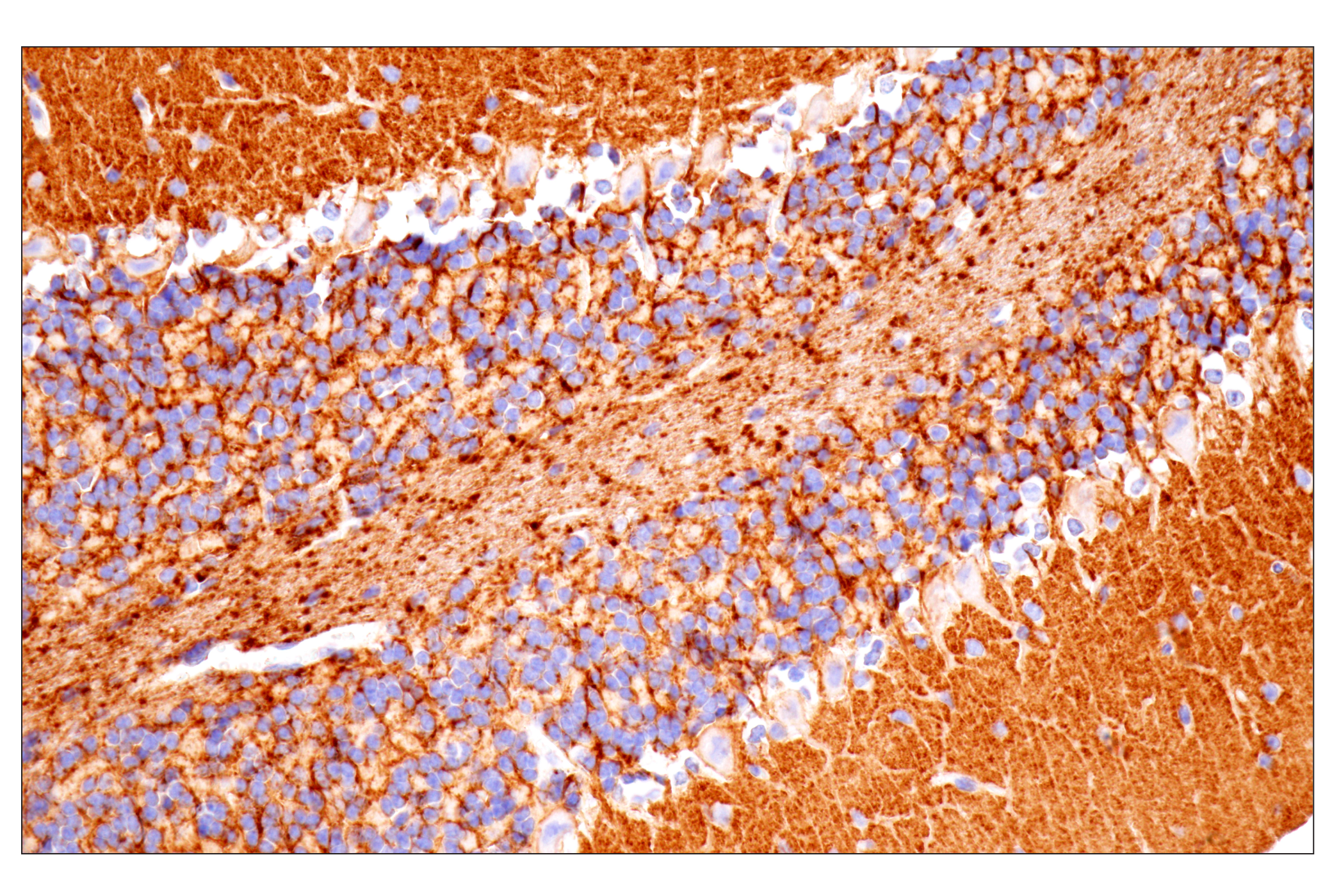Immunohistochemistry Image 7: PTPRZ1 (E7C8Z) Rabbit mAb (BSA and Azide Free)