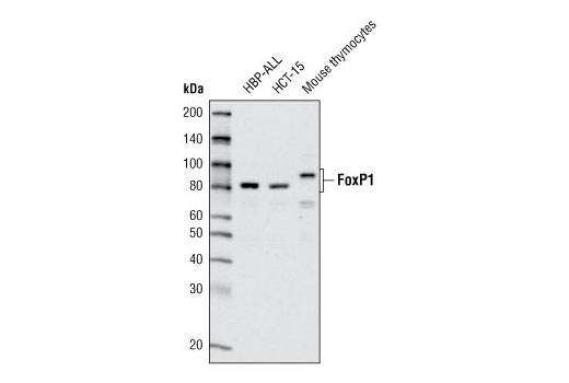 Western Blotting Image 1: FoxP1 Antibody