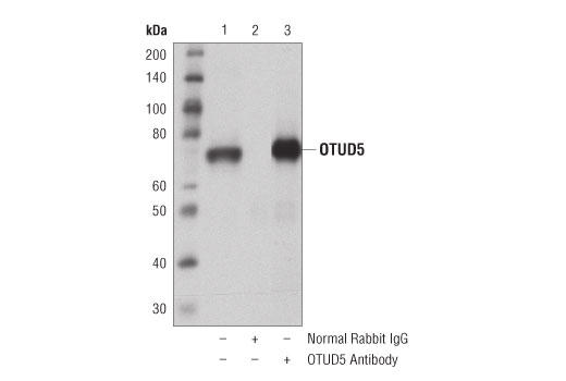 Immunoprecipitation Image 1: OTUD5 Antibody