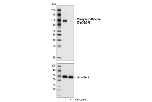 Western Blotting Image 2: Phospho-β-Catenin (Ser33/37) Antibody