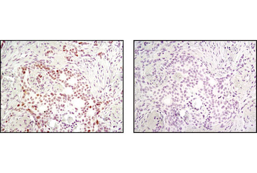 Immunohistochemistry Image 1: MSH2 (D24B5) XP® Rabbit mAb