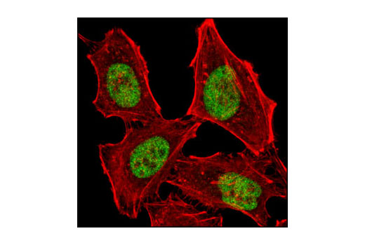 Immunofluorescence Image 1: MSH2 (D24B5) XP® Rabbit mAb