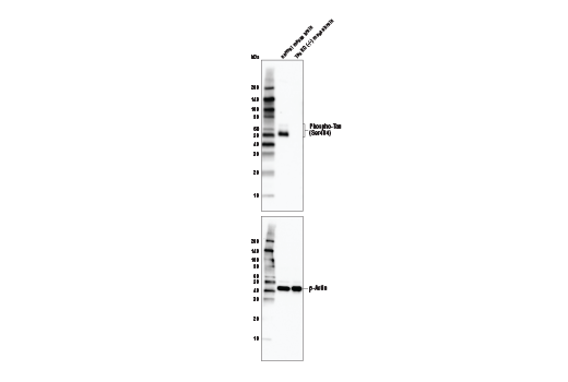  Image 5: Phospho-Tau Family Antibody Sampler Kit