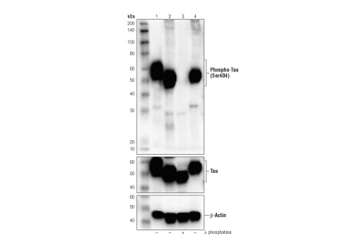  Image 13: Phospho-Tau Family Antibody Sampler Kit