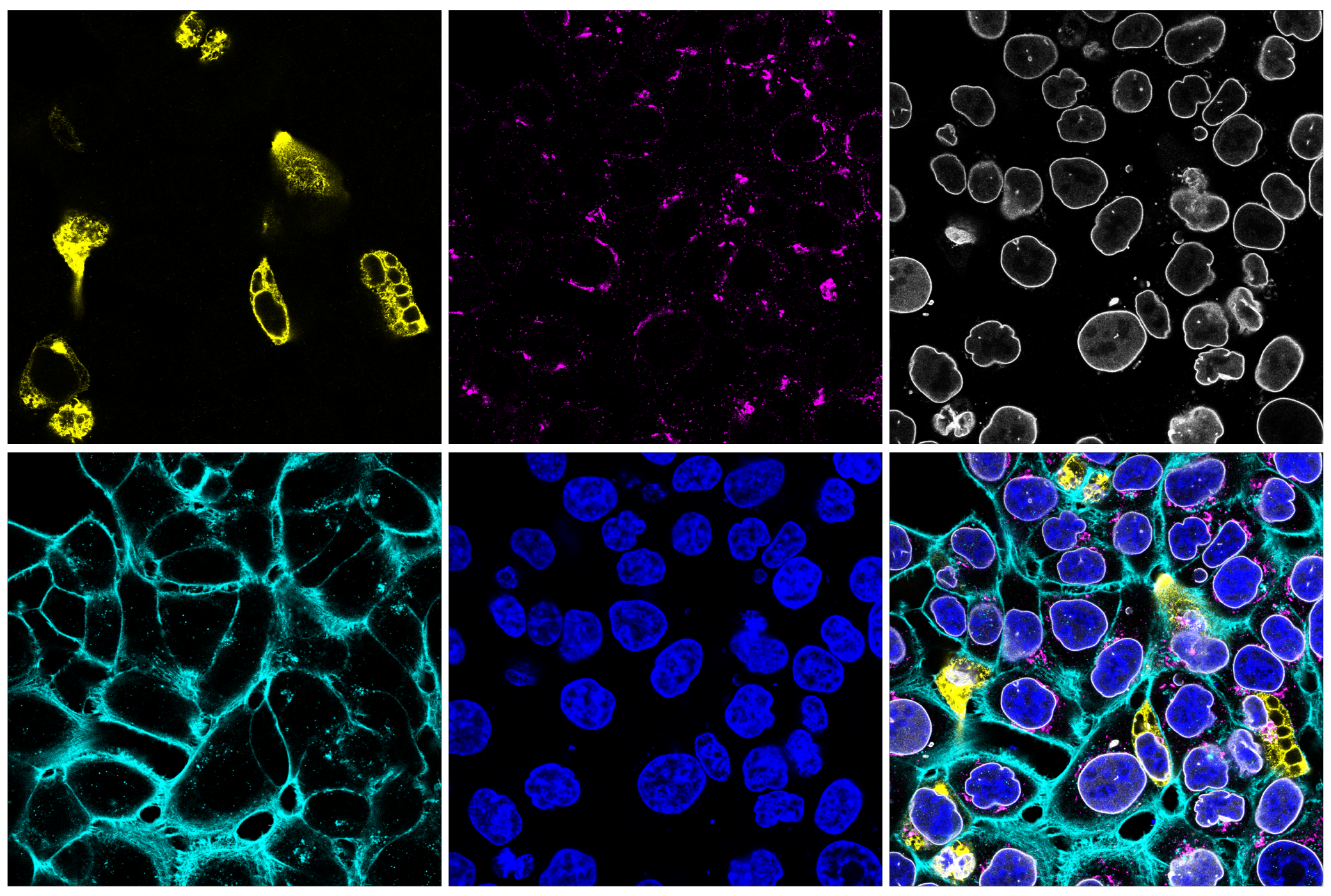 Immunofluorescence Image 1: Myc-Tag (E4F4D) Mouse mAb