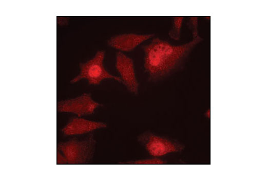 Immunofluorescence Image 1: PP2A C Subunit Antibody