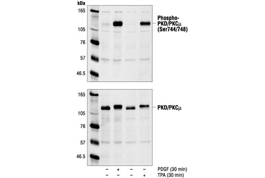 Western Blotting Image 1: Phospho-PKD/PKCμ (Ser744/748) Antibody