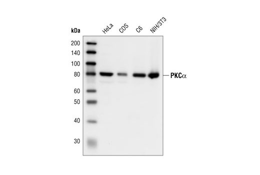 Western Blotting Image 1: PKCα Antibody