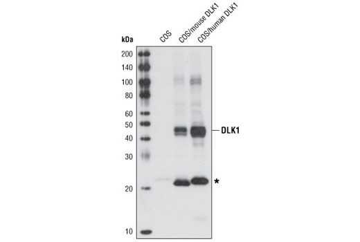 Western Blotting Image 1: DLK1 Antibody
