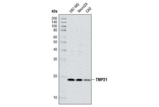 Western Blotting Image 1: TMP21 Antibody