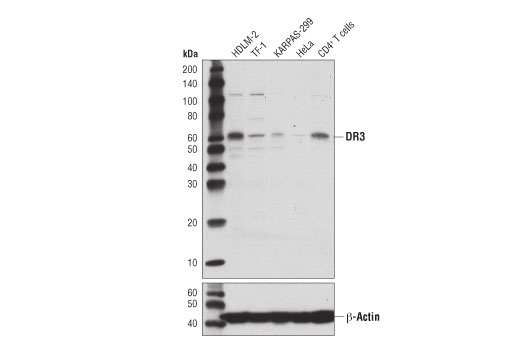  Image 2: Death Receptor Antibody Sampler Kit II