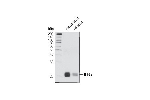 Western Blotting Image 1: RhoB Antibody