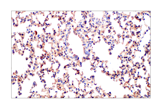 Immunohistochemistry Image 9: Src (36D10) Rabbit mAb