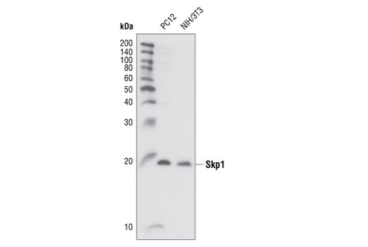 Western Blotting Image 1: Skp1 Antibody