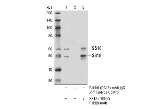 Immunoprecipitation Image 1: SS18 (D6I4Z) Rabbit mAb