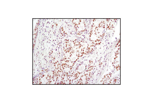  Image 15: Nucleus and Nuclear Envelope-Associated Marker Proteins Antibody Sampler Kit