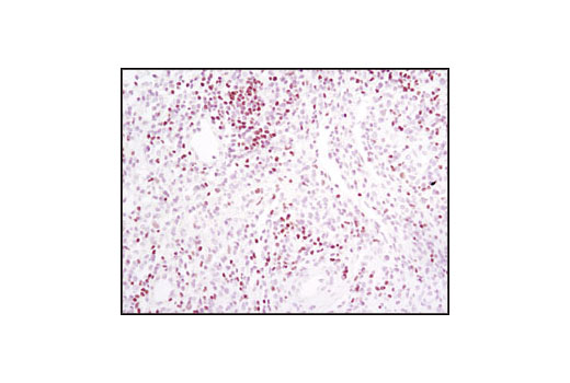 Immunohistochemistry Image 1: TCF1/TCF7 (C63D9) Rabbit mAb