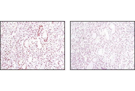 Immunohistochemistry Image 2: TCF1/TCF7 (C63D9) Rabbit mAb