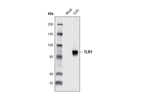 Western Blotting Image 1: Toll-like Receptor 1 Antibody