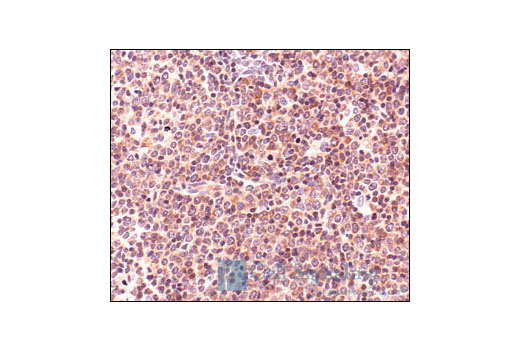 Immunohistochemistry Image 3: S6 Ribosomal Protein (5G10) Rabbit mAb (BSA and Azide Free)