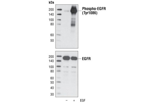 Western Blotting Image 1: Phospho-EGF Receptor (Tyr1086) Antibody
