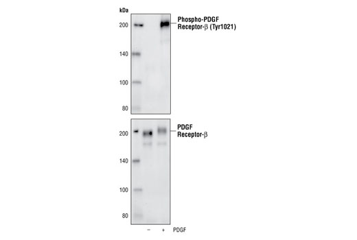 Western Blotting Image 1: Phospho-PDGF Receptor β (Tyr1021) (6F10) Rabbit mAb