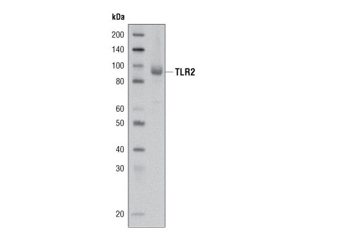 Western Blotting Image 1: Toll-like Receptor 2 Antibody