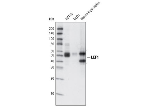  Image 7: Wnt/β-Catenin Activated Targets Antibody Sampler Kit