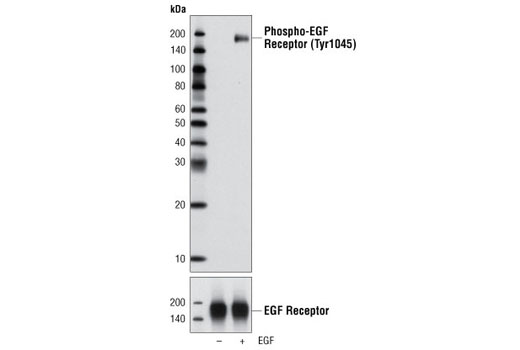  Image 4: Phospho-EGF Receptor Antibody Sampler Kit