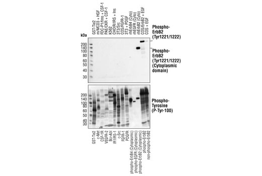  Image 2: Phospho-HER2/ErbB2 Antibody Sampler Kit
