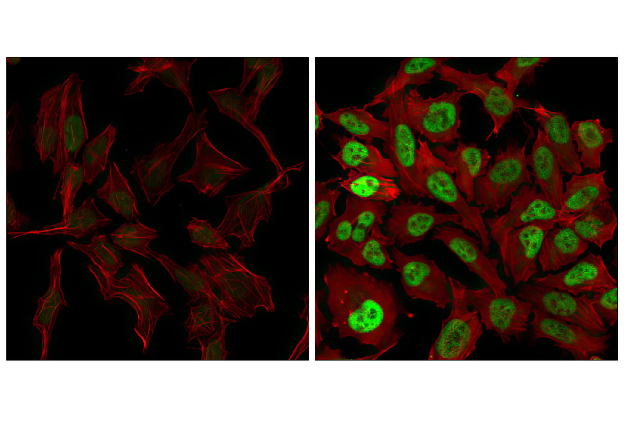 Immunofluorescence Image 3: c-Fos (9F6) Rabbit mAb
