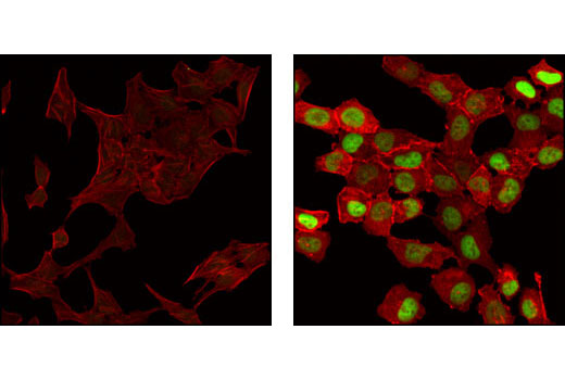 Immunofluorescence Image 1: FosB (5G4) Rabbit mAb