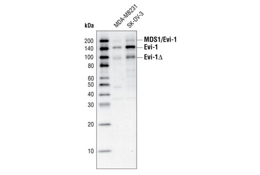 Western Blotting Image 1: Evi-1 Antibody