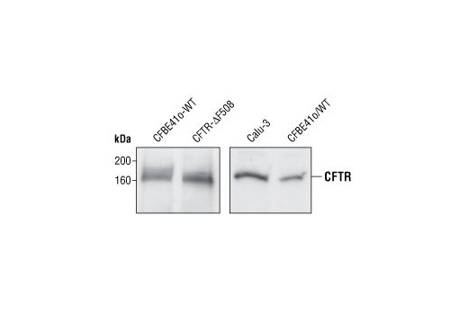 Western Blotting Image 1: CFTR Antibody