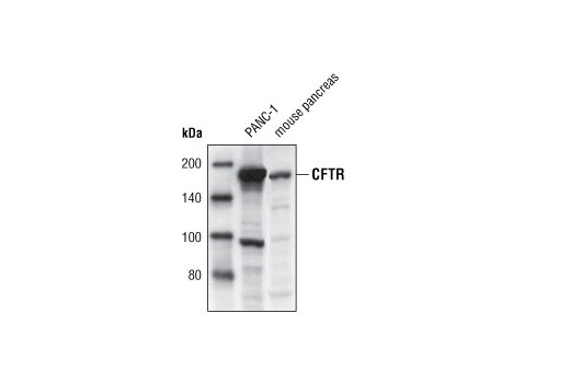 Western Blotting Image 2: CFTR Antibody