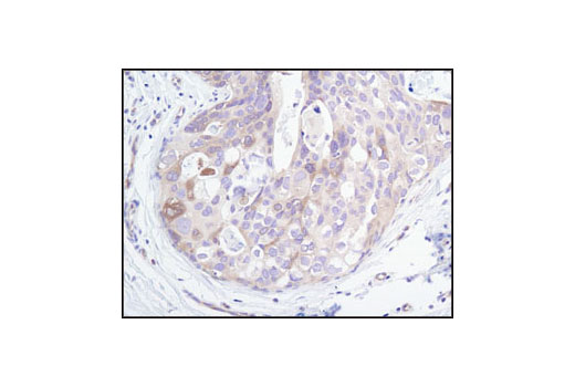 Immunohistochemistry Image 1: PP2A B Subunit (100C1) Rabbit mAb