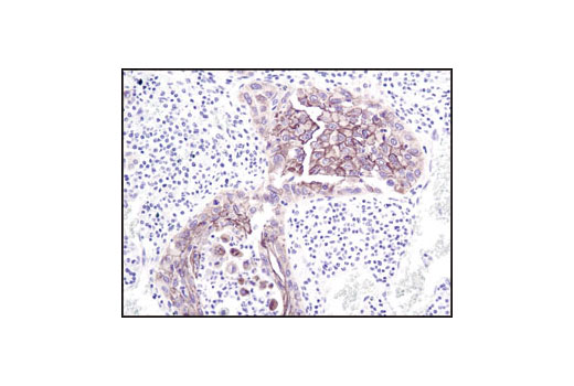  Image 19: Adherens Junction Antibody Sampler Kit