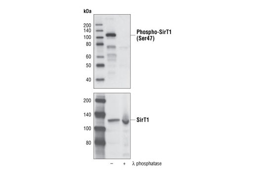 Western Blotting Image 1: Phospho-SirT1 (Ser47) Antibody