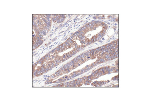 Immunohistochemistry Image 2: S6 Ribosomal Protein (54D2) Mouse mAb