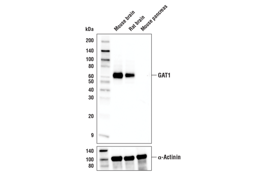 Western Blotting Image 1: GAT1 Antibody