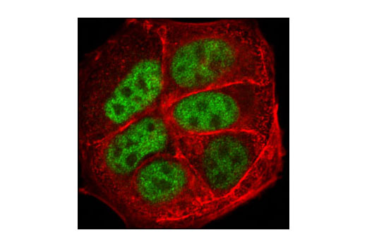 Immunofluorescence Image 1: AP-2γ Antibody