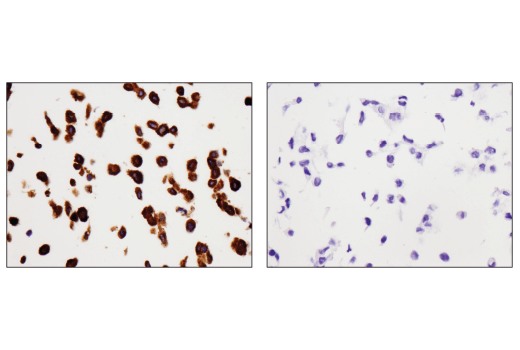 Immunohistochemistry Image 1: SQSTM1/p62 (D6M5X) Rabbit mAb