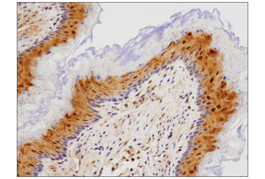 Immunohistochemistry Image 2: SQSTM1/p62 (D6M5X) Rabbit mAb