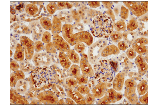 Immunohistochemistry Image 3: SQSTM1/p62 (D6M5X) Rabbit mAb