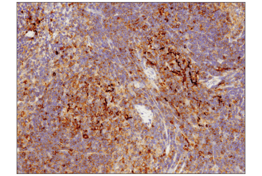 Immunohistochemistry Image 4: SQSTM1/p62 (D6M5X) Rabbit mAb