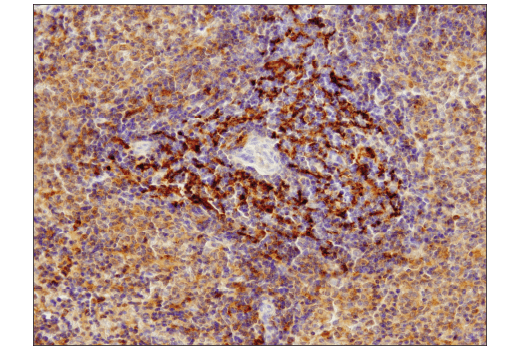 Immunohistochemistry Image 5: SQSTM1/p62 (D6M5X) Rabbit mAb